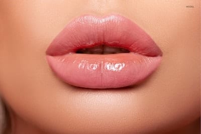 Woman with overly full lips